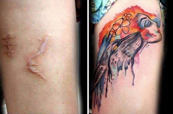 I tatuaggi che trasformano cicatrici in opere d’arte 